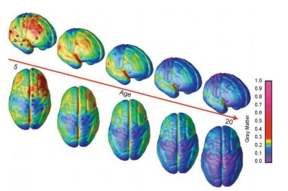 Zwiers pnas brain development image